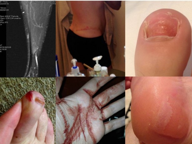 Injuries - November 16th 2012